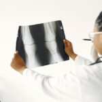 A doctor examining an x-ray