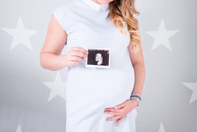 pregnancy photoshoot, women holding picture of baby ultrasound