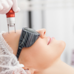 Lady undergoing laser skin treatment.