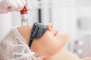 Lady undergoing laser skin treatment.