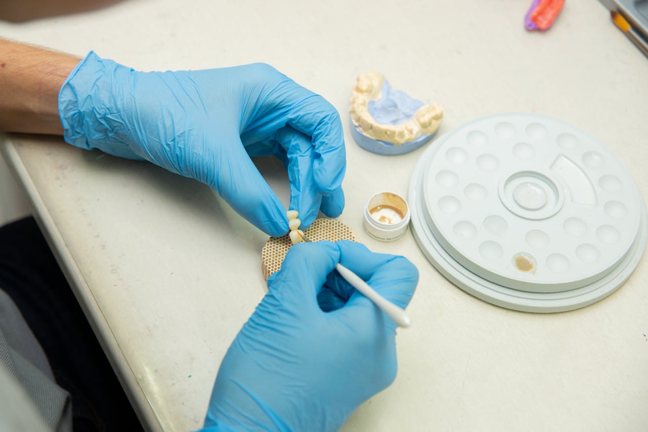 How Full Mouth Implants Improve Comfort Confidence and Health