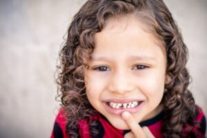Smiling child with curly hair in a close-up portrait, showing a missing front tooth after a typical childhood dental moment.